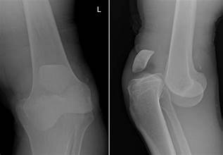 X-ray